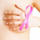 Tin vui cho bệnh nhân bị ung thư vú: Không cần cắt vú vẫn chữa được ung thư