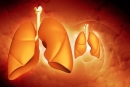Thử nghiệm chỉ ra tương tác giữa đột biến KRAS và  Erlotinib trị liệu trong ung thư phổi không tế bào nhỏ
